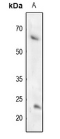 TFCP2L1 Rabbit Polyclonal Antibody