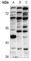 GFI1B Rabbit Polyclonal Antibody