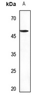 Septin 8 Rabbit Polyclonal Antibody