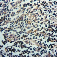 Septin 8 Rabbit Polyclonal Antibody