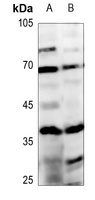 ABHD4 Rabbit Polyclonal Antibody