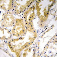 ABHD4 Rabbit Polyclonal Antibody