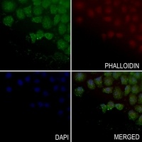 ABHD4 Rabbit Polyclonal Antibody