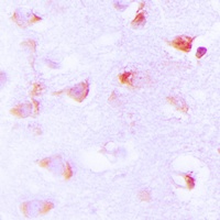 ACC alpha (Phospho-S80) Antibody
