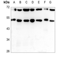 ADAMDEC1 Rabbit Polyclonal Antibody