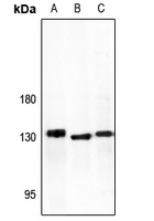 ADAMTS10 Rabbit Polyclonal Antibody