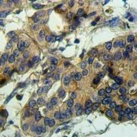 ADAMTS10 Rabbit Polyclonal Antibody