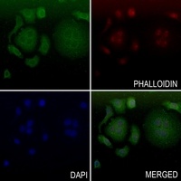 ADAMTS10 Rabbit Polyclonal Antibody
