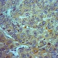 ALDH1A1 Rabbit Polyclonal Antibody