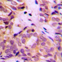 ALDH1A2 Rabbit Polyclonal Antibody