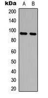 AMPD2 Rabbit Polyclonal Antibody
