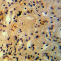 AMPD2 Rabbit Polyclonal Antibody