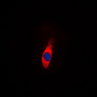 AMPD2 Rabbit Polyclonal Antibody