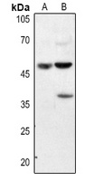 Annexin A7 Rabbit Polyclonal Antibody
