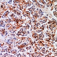 Annexin A7 Rabbit Polyclonal Antibody