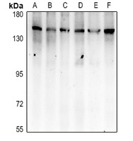APAF-1 Rabbit Polyclonal Antibody