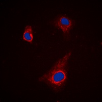 ATG4C Rabbit Polyclonal Antibody