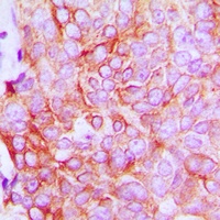 ATP1A1 Rabbit Polyclonal Antibody