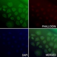 ATP6V0A2 Rabbit Polyclonal Antibody