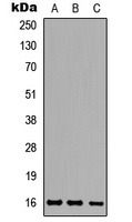Ataxin 7L1 Rabbit Polyclonal Antibody
