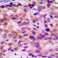 Ataxin 7L1 Rabbit Polyclonal Antibody