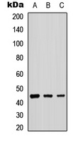 B4GALT2 Rabbit Polyclonal Antibody