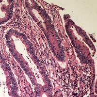 B4GALT2 Rabbit Polyclonal Antibody
