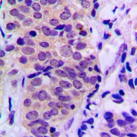 BAD (Phospho-S155) Antibody