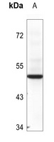 BAG1 Rabbit Polyclonal Antibody