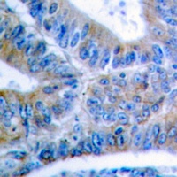 BCLX (Phospho-S62) Antibody