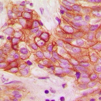 Calmodulin (Phospho-T80/S82) Antibody