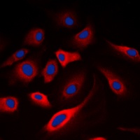 Calmodulin (Phospho-T80/S82) Antibody