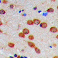 CaMK2 alpha/delta (Phospho-T286) Antibody