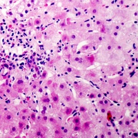 CEP110 Rabbit Polyclonal Antibody
