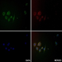 CD101 Rabbit Polyclonal Antibody