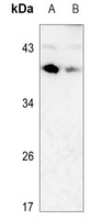 CD79b Antibody