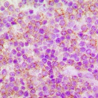CDC25A (Phospho-S75) Antibody
