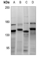 CDCA2 Rabbit Polyclonal Antibody