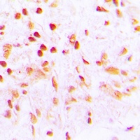 CDCA2 Rabbit Polyclonal Antibody