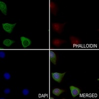 CDCA2 Rabbit Polyclonal Antibody