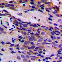 CDK5 (Phospho-Y15) Antibody