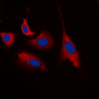 CDK5 (Phospho-Y15) Antibody