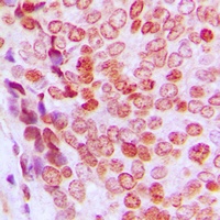 p21 (Phospho-T145) Antibody