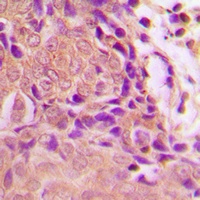 p16 INK4a (Phospho-S152) Antibody