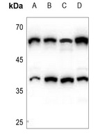 CERKL Rabbit Polyclonal Antibody