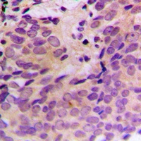 CERKL Rabbit Polyclonal Antibody