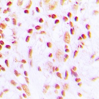 CHK2 (Phospho-T387) Antibody