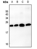 Claudin 3 Rabbit Polyclonal Antibody