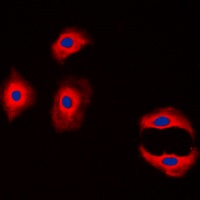 Claudin 3 Rabbit Polyclonal Antibody