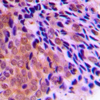 CLOCK Rabbit Polyclonal Antibody